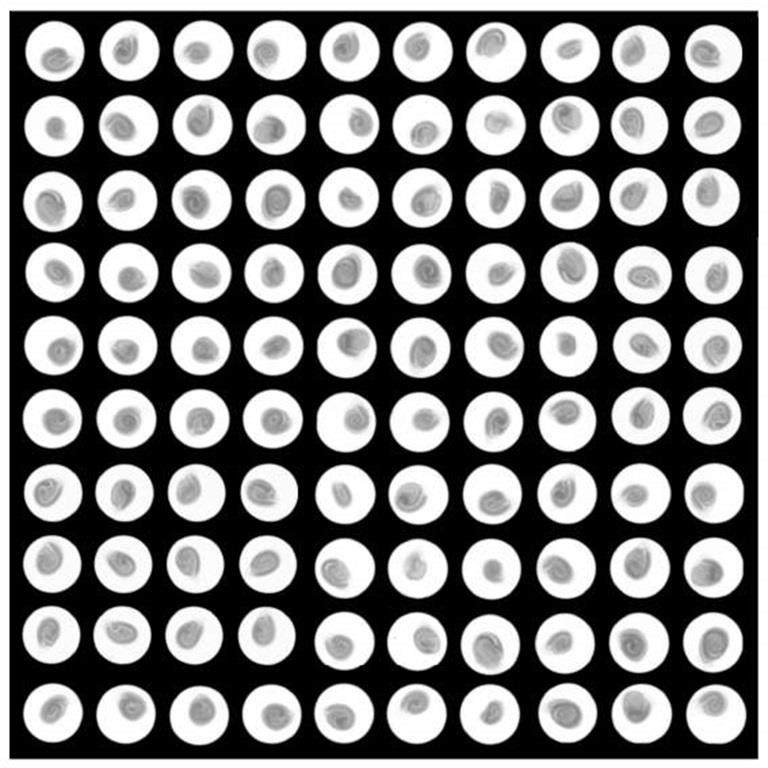 トマトの種のX線写真